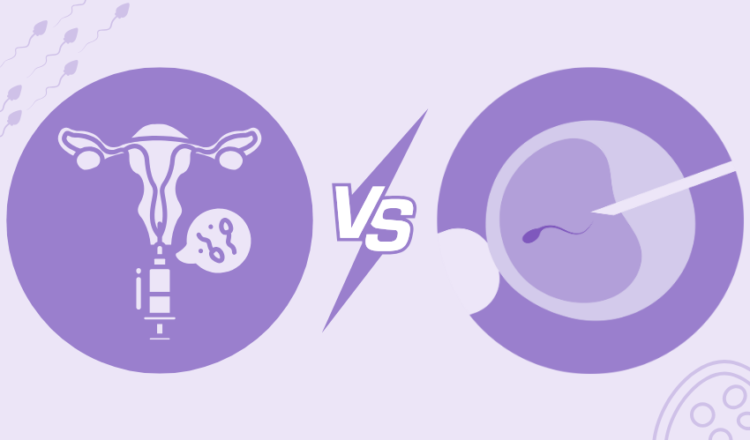 IUI vs IVF
