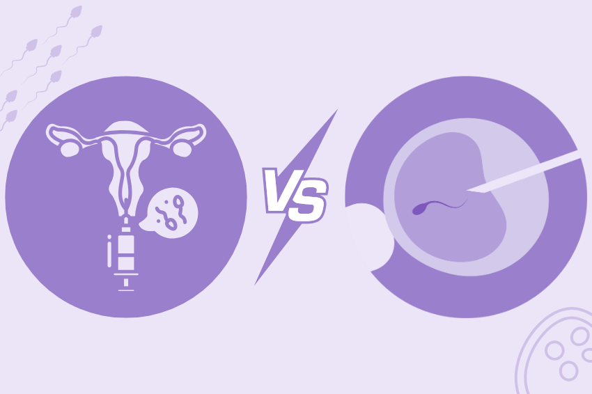 IUI vs IVF